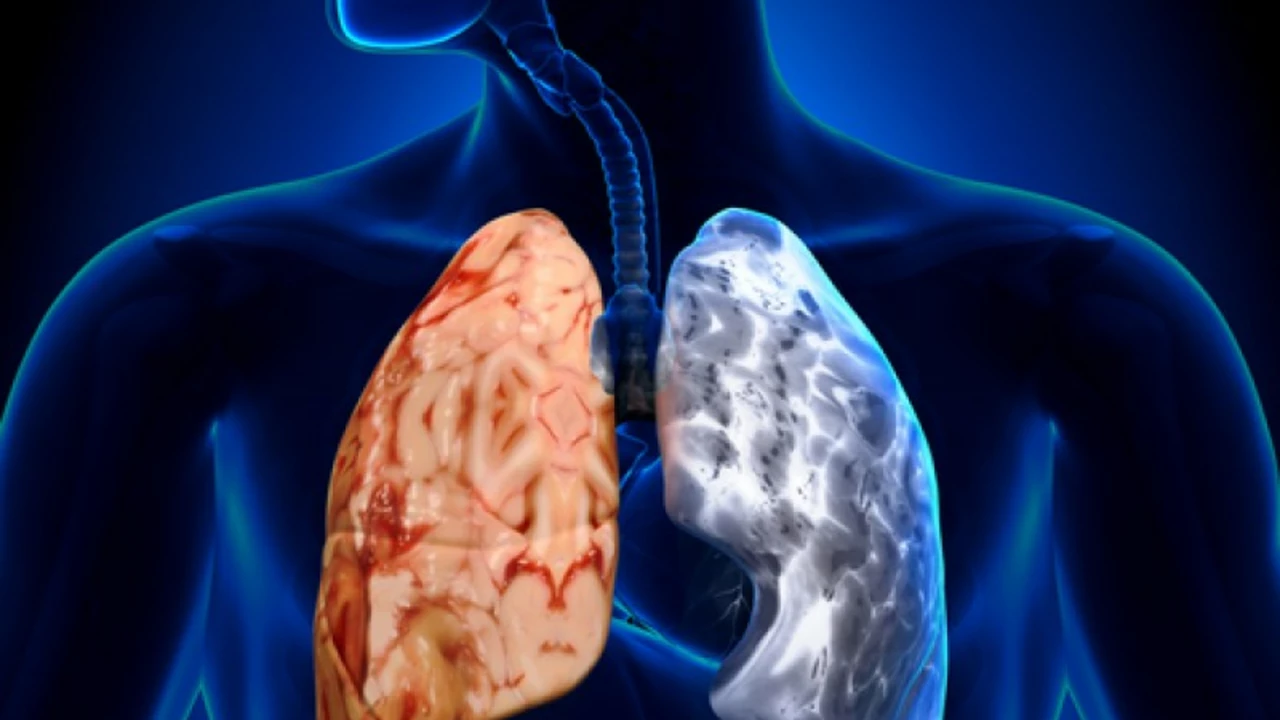 La Conexión entre la Enfermedad Pulmonar Obstructiva Crónica y la Apnea del Sueño